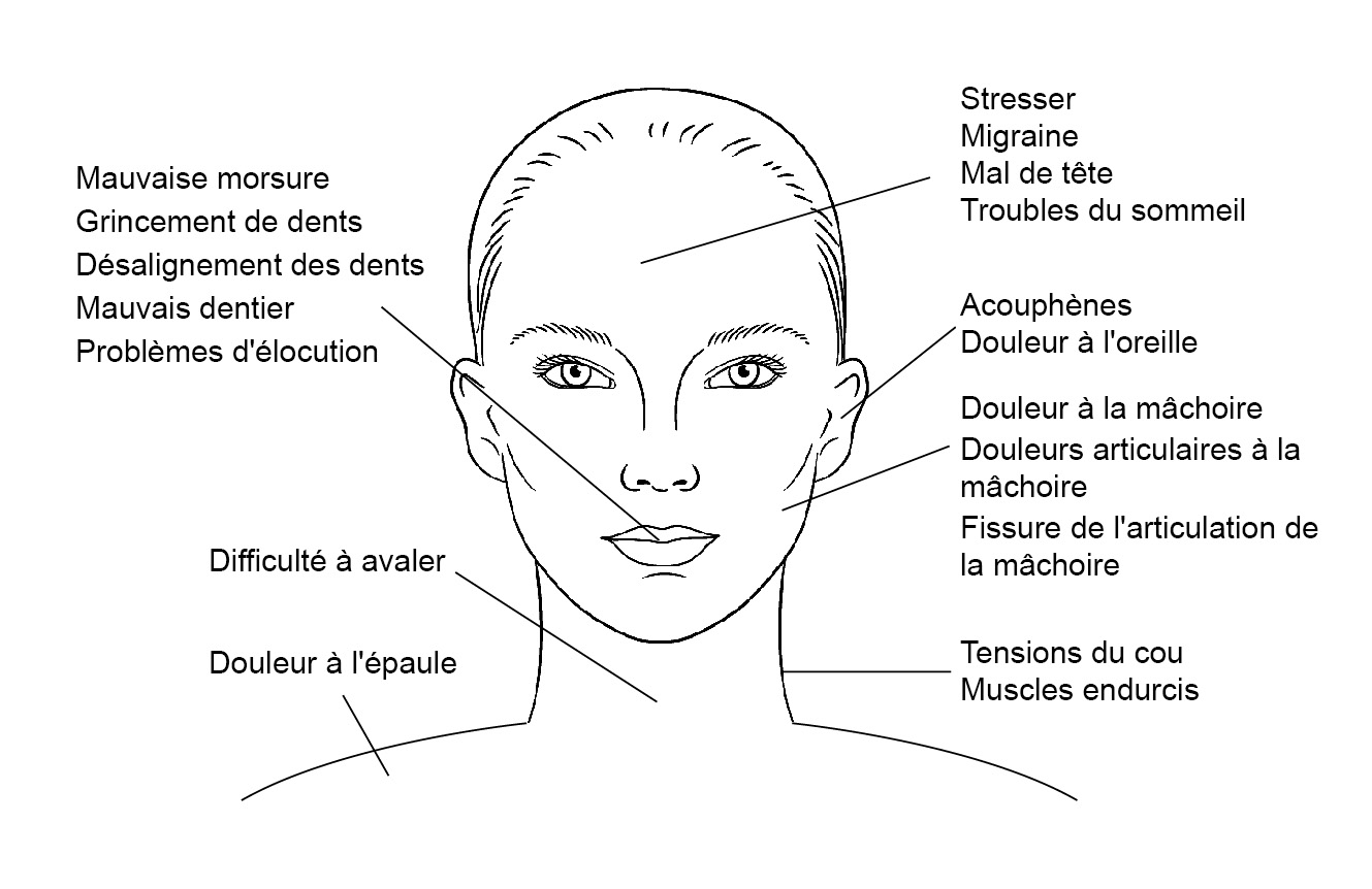 Thérapie par attelle pour les dents